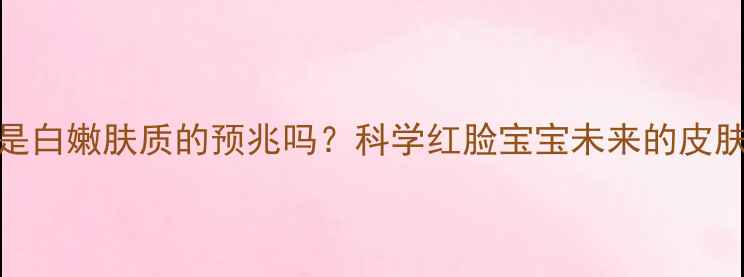 图片 婴儿脸红是白嫩肤质的预兆吗？科学红脸宝宝未来的皮肤发育趋势