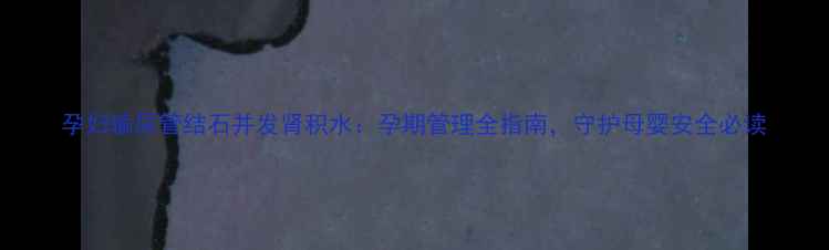 图片 孕妇输尿管结石并发肾积水：孕期管理全指南，守护母婴安全必读