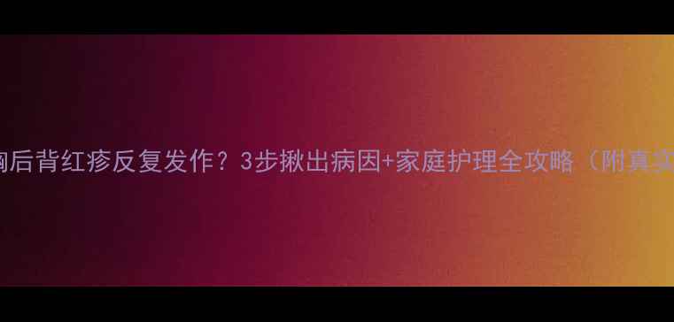 图片 宝宝前胸后背红疹反复发作？3步揪出病因+家庭护理全攻略（附真实案例）1