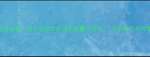 图片 幼儿教育必看！孩子后背红印背后的警示信号，3步科学引导代替体罚