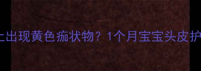 图片 新生儿头上出现黄色痂状物？1个月宝宝头皮护理全攻略2