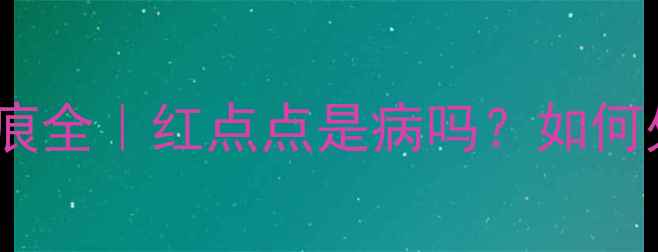 图片 新生儿鹤吻痕全｜红点点是病吗？如何处理不焦虑1