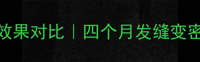 图片 👶产后脱发恢复期四个月效果对比｜四个月发缝变密了怎么办？附护理全攻略