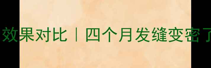 图片 👶产后脱发恢复期四个月效果对比｜四个月发缝变密了怎么办？附护理全攻略1