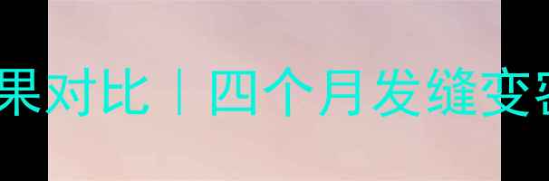 图片 👶产后脱发恢复期四个月效果对比｜四个月发缝变密了怎么办？附护理全攻略2